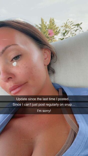 🔥 Brittney atwood page leaked private photo uncensored full